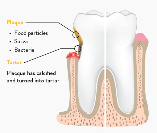 Signs of dental disease